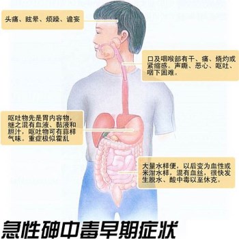 儿童微量元素检测仪分析砷中毒的危害?kaifa